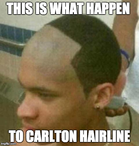 THIS IS WHAT HAPPEN  TO CARLTON HAIRLINE | image tagged in hairline | made w/ Imgflip meme maker