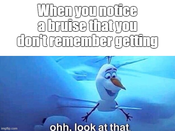 How'd that even get there? | When you notice a bruise that you don't remember getting | image tagged in frozen,olaf,i've been impaled,ouch,why are you reading this | made w/ Imgflip meme maker