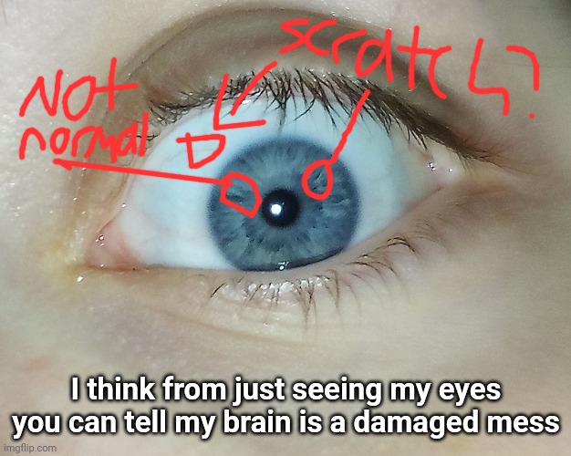 Ahhhhhhuu | I think from just seeing my eyes you can tell my brain is a damaged mess | made w/ Imgflip meme maker