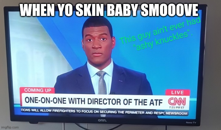 ASHY KNUCKLES | WHEN YO SKIN BABY SMOOOVE | image tagged in ashy knuckles | made w/ Imgflip meme maker