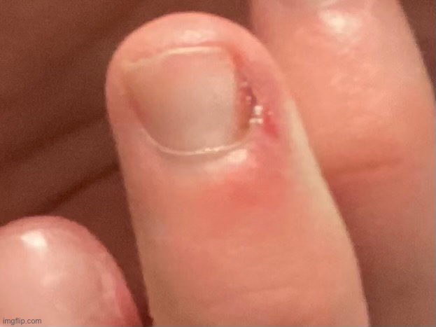 There’s the gore now shut up | made w/ Imgflip meme maker