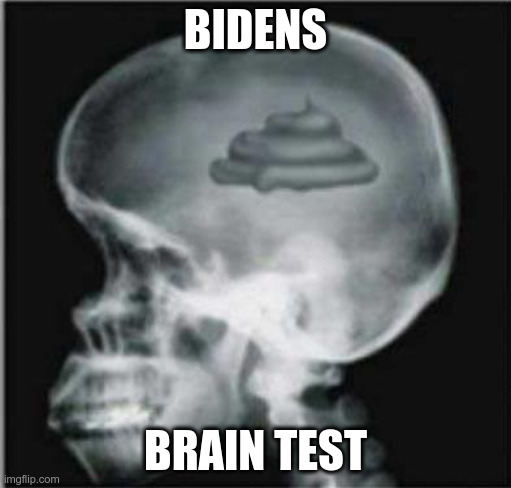 Shit for brains | BIDENS; BRAIN TEST | image tagged in shit for brains | made w/ Imgflip meme maker