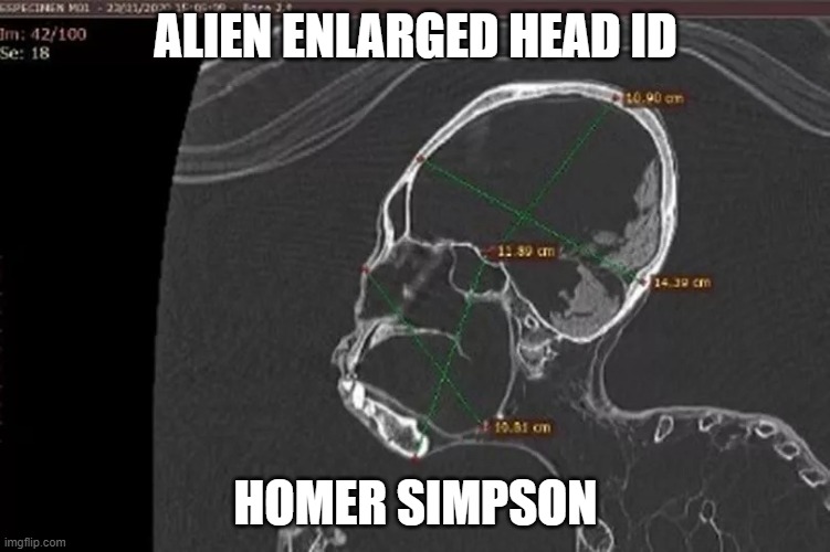 ALIEN HEAD IS HOMER SIMPSON | ALIEN ENLARGED HEAD ID; HOMER SIMPSON | image tagged in alien head is homer simpson | made w/ Imgflip meme maker