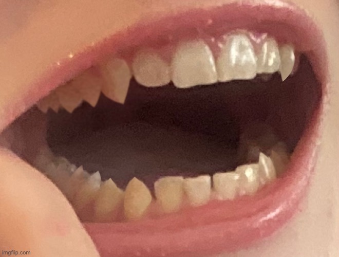Another teeth picture | made w/ Imgflip meme maker