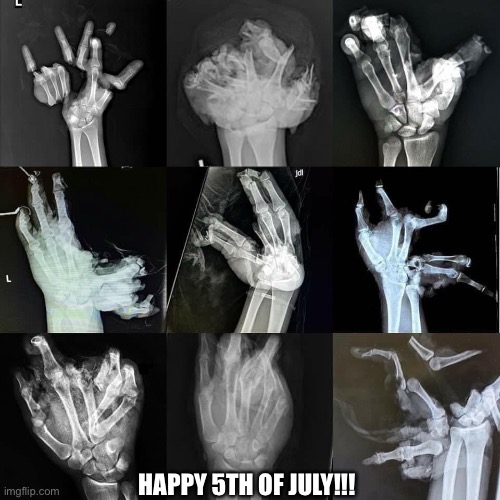 What about July 5th? | HAPPY 5TH OF JULY!!! | image tagged in firework season,fourth of july,bad day,after,shit happens | made w/ Imgflip meme maker