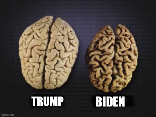 This is a normal brain vs. a brain of someone with dementia — The brain physically shrinks, and is replaced with cranial fluid. | TRUMP; BIDEN | image tagged in brain,dementia,the cat is out of the bag | made w/ Imgflip meme maker