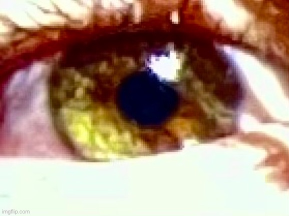 My incredibly rare eye color (segmental heterochromia) | made w/ Imgflip meme maker
