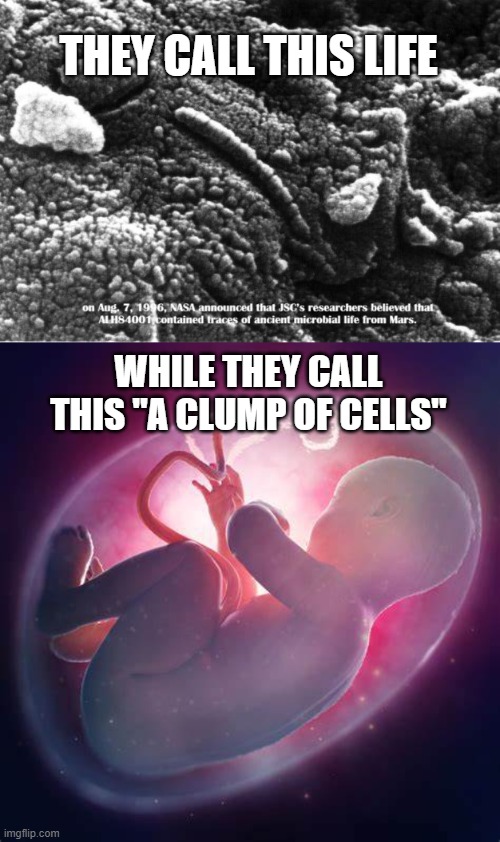 Life, Or A Clump Of Cells? | THEY CALL THIS LIFE; WHILE THEY CALL THIS "A CLUMP OF CELLS" | image tagged in abortion,life,chooselife | made w/ Imgflip meme maker