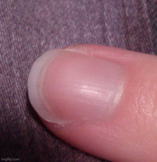 fingernail reveal as promised (pointer finger) | image tagged in fingernail,reveal | made w/ Imgflip meme maker