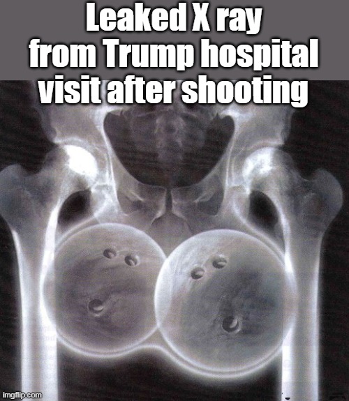 Winston Churchill: "There is nothing more exhilarating than to be shot at with no result" | Leaked X ray from Trump hospital visit after shooting | image tagged in trump ginormous balls meme | made w/ Imgflip meme maker