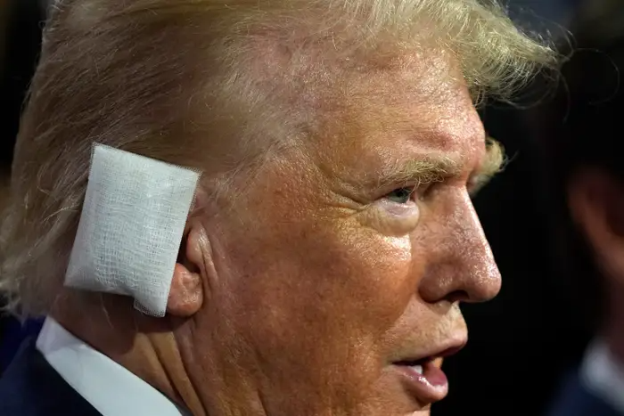 High Quality Trump Ear Bandage Blank Meme Template