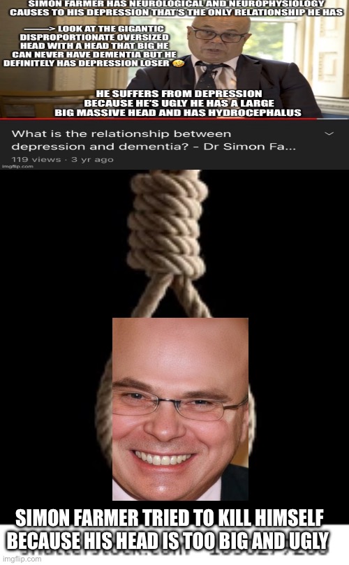 Simon farmer tried to kill himself because his head is too big | SIMON FARMER TRIED TO KILL HIMSELF BECAUSE HIS HEAD IS TOO BIG AND UGLY | image tagged in depression,big head,forehead,head,ugly,funny | made w/ Imgflip meme maker