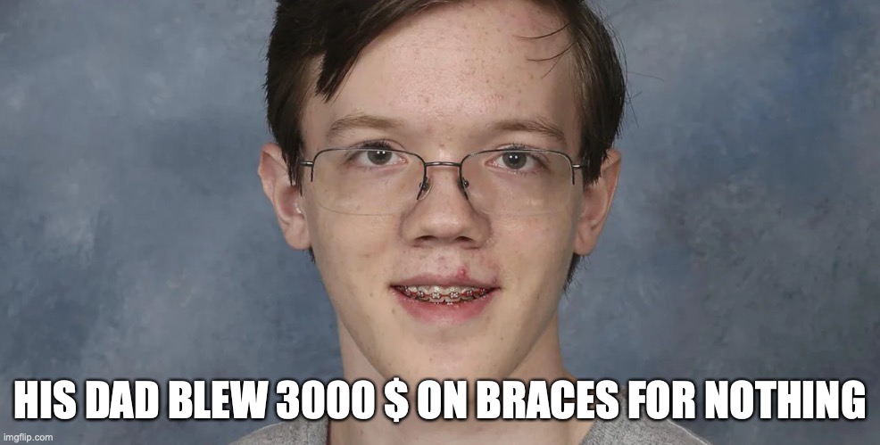 Braces | HIS DAD BLEW 3000 $ ON BRACES FOR NOTHING | image tagged in donald trump,thomas matthew | made w/ Imgflip meme maker