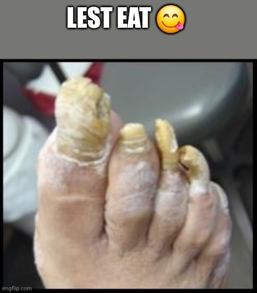 Ugly Toe Nails | LEST EAT 😋 | image tagged in ugly toe nails | made w/ Imgflip meme maker
