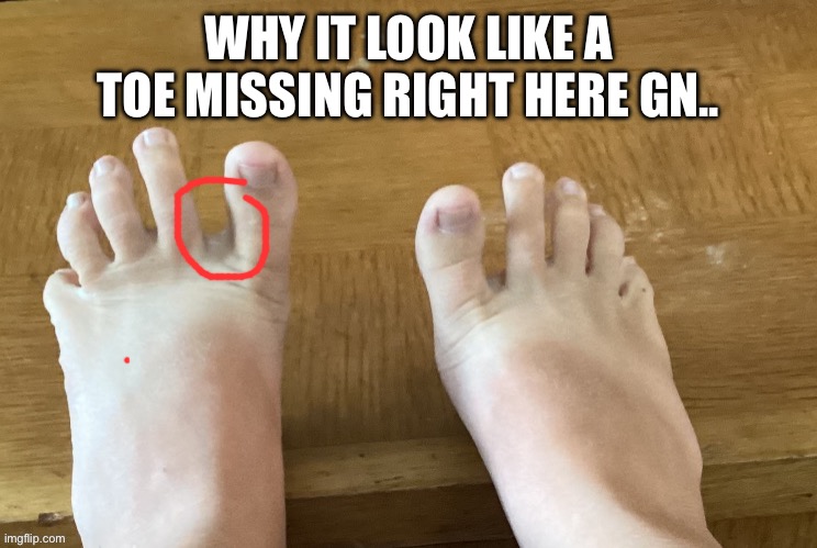Wide ass feet | WHY IT LOOK LIKE A TOE MISSING RIGHT HERE GN.. | image tagged in icyxd feet v4 | made w/ Imgflip meme maker