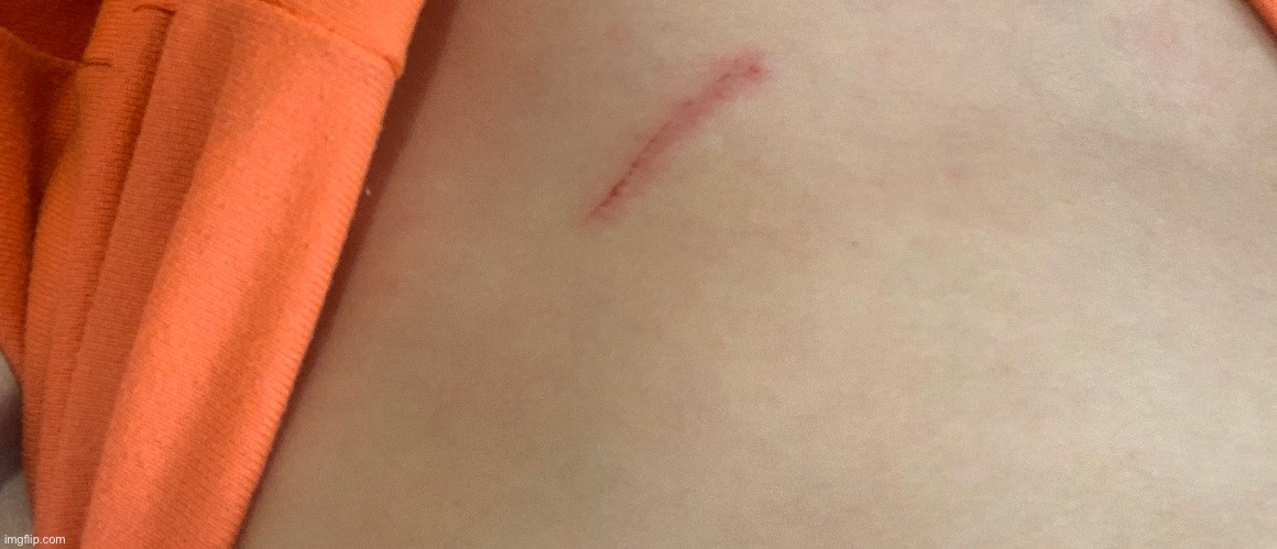 Owie 3: | made w/ Imgflip meme maker