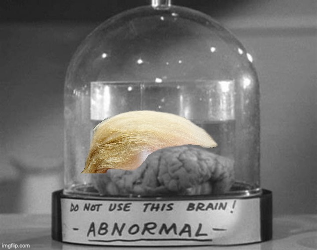 Abnormal brain | image tagged in abnormal brain | made w/ Imgflip meme maker