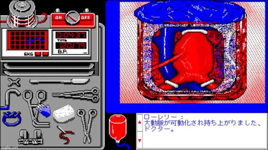 PC98 aneurysm surgery | image tagged in life and death aneurysm graft | made w/ Imgflip meme maker