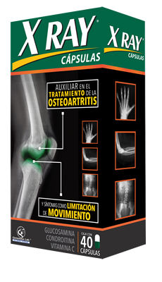 High Quality X Ray medicina para reumatismo y articulaciones Blank Meme Template