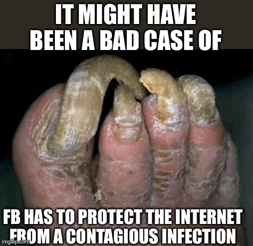 Toenails | IT MIGHT HAVE BEEN A BAD CASE OF FB HAS TO PROTECT THE INTERNET FROM A CONTAGIOUS INFECTION | image tagged in toenails | made w/ Imgflip meme maker