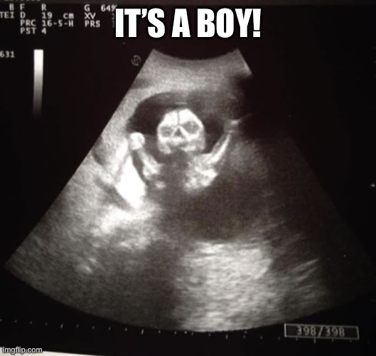 ultrasound | IT’S A BOY! | image tagged in ultrasound | made w/ Imgflip meme maker