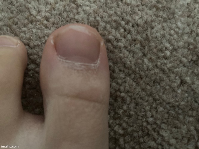 Toe | image tagged in toe | made w/ Imgflip meme maker