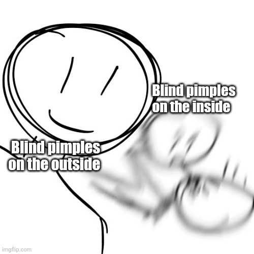 Itching like crazy right now , applied boro plus | Blind pimples on the inside; Blind pimples on the outside | image tagged in acne | made w/ Imgflip meme maker