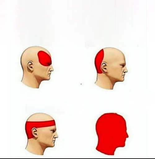 Types of Headaches (blank) Blank Meme Template