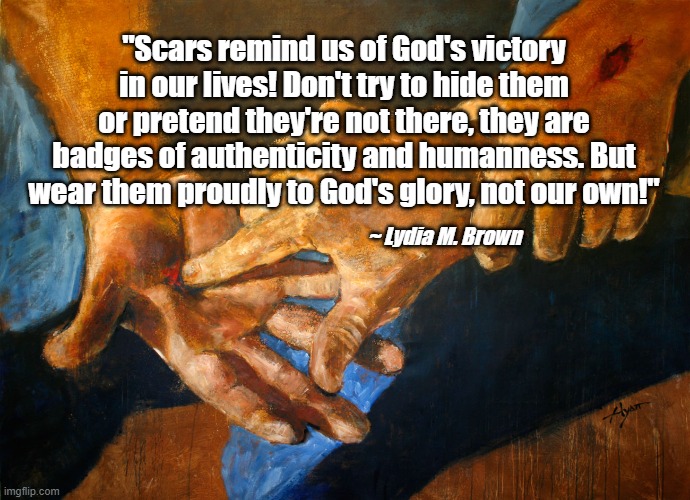 Nail scarred hands | "Scars remind us of God's victory in our lives! Don't try to hide them or pretend they're not there, they are badges of authenticity and humanness. But wear them proudly to God's glory, not our own!"; ~ Lydia M. Brown | image tagged in nail scarred hands | made w/ Imgflip meme maker