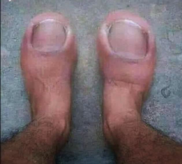 High Quality Croc Feet Blank Meme Template