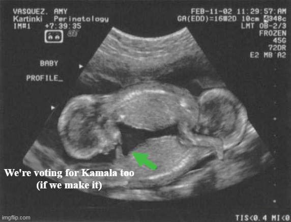 White Babies For Harris (if they survive the vacuum) | We're voting for Kamala too
(if we make it) | image tagged in babies for harris meme | made w/ Imgflip meme maker