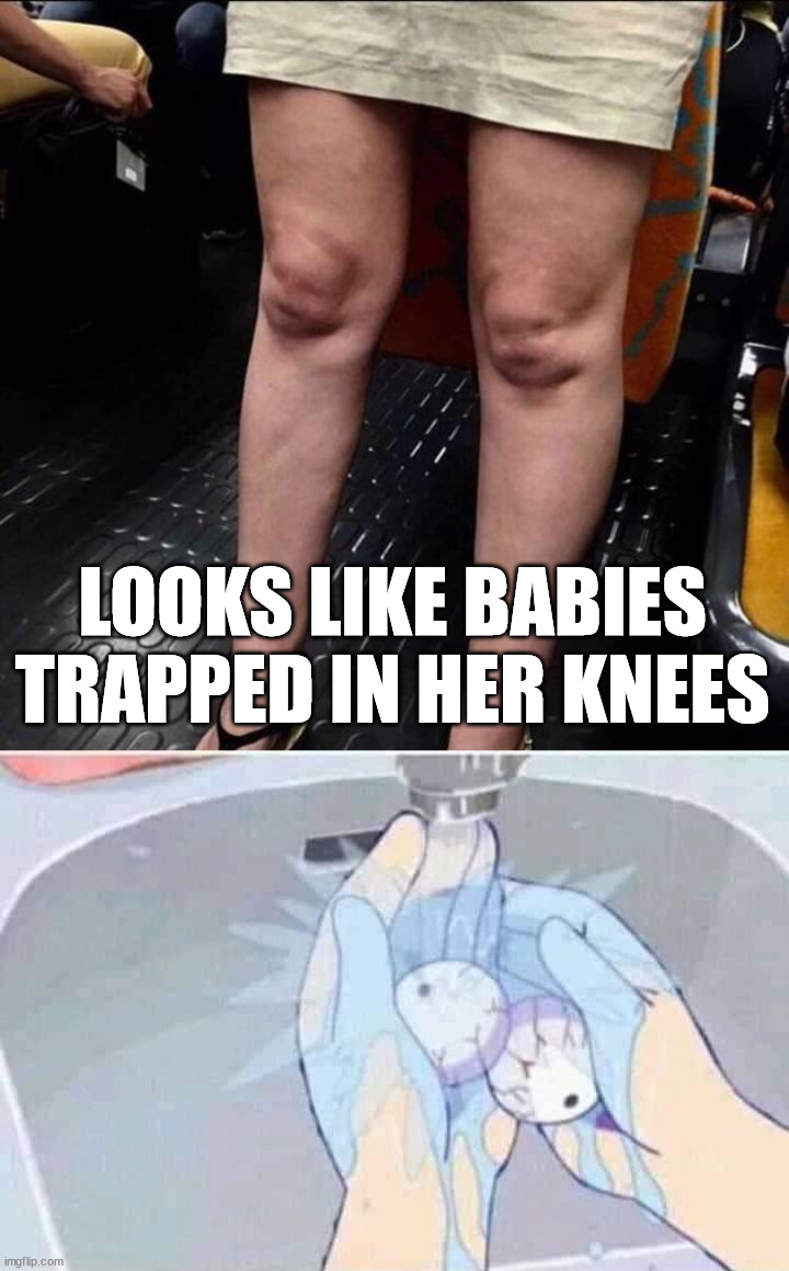 Freaky knees | LOOKS LIKE BABIES TRAPPED IN HER KNEES | image tagged in cursed image | made w/ Imgflip meme maker