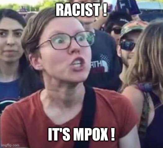 Angry Liberal | RACIST ! IT'S MPOX ! | image tagged in angry liberal | made w/ Imgflip meme maker