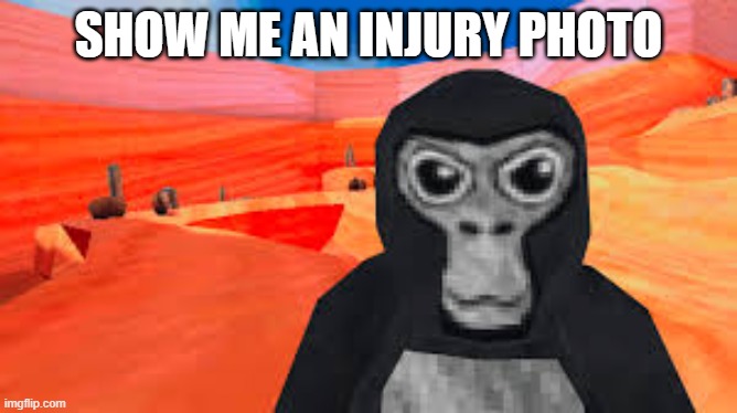 gorilla tag | SHOW ME AN INJURY PHOTO | image tagged in gorilla tag | made w/ Imgflip meme maker