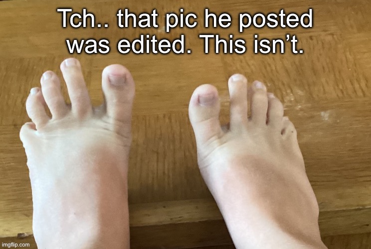 IcyXD FEET!!! v4 | Tch.. that pic he posted was edited. This isn’t. | image tagged in icyxd feet v4 | made w/ Imgflip meme maker