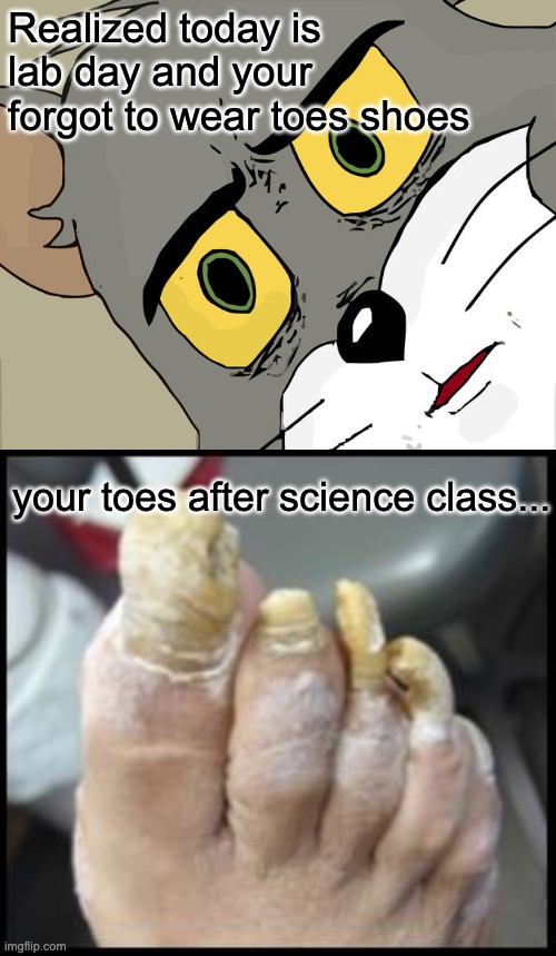 Wear closed toe shoes | Realized today is lab day and your forgot to wear toes shoes; your toes after science class... | image tagged in memes,unsettled tom,ugly toe nails | made w/ Imgflip meme maker