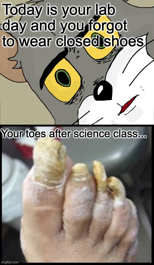 Wear closed toe shoes | Today is your lab day and you forgot to wear closed shoes; Your toes after science class... | image tagged in memes,unsettled tom,ugly toe nails | made w/ Imgflip meme maker