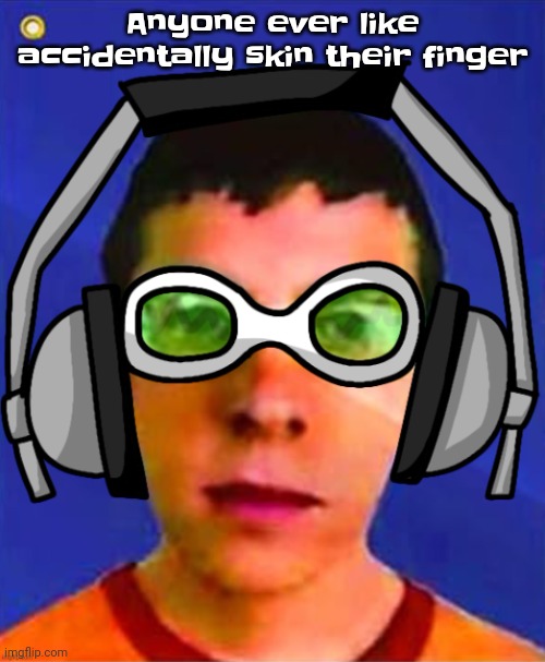 Like dude I skinned my thumb cuz I ate all the hangnail | Anyone ever like accidentally skin their finger | image tagged in spam sega with this until a new jsr game comes out | made w/ Imgflip meme maker