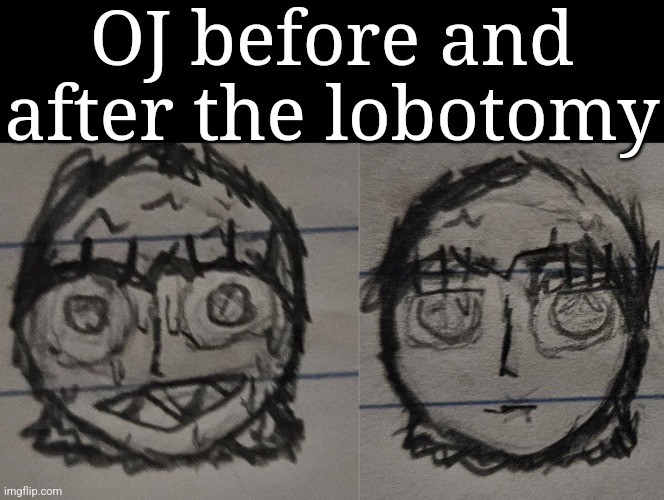 OJ before and after the lobotomy | made w/ Imgflip meme maker