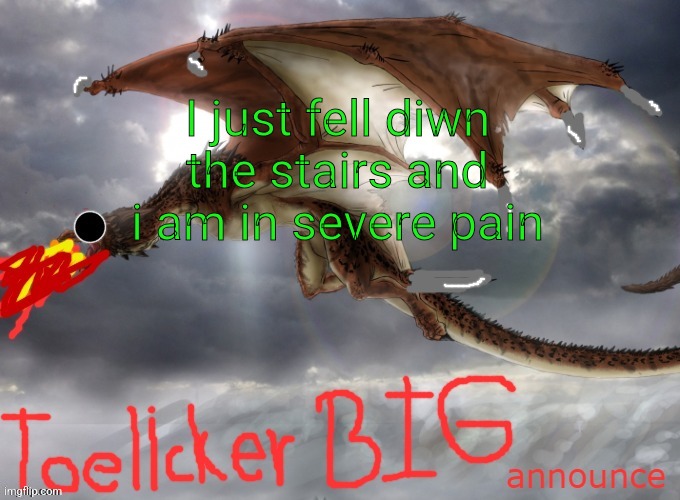 I wanna go home | I just fell diwn the stairs and i am in severe pain | image tagged in toelicker43 big announce | made w/ Imgflip meme maker
