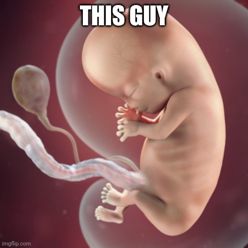 10 Week Fetus | THIS GUY | image tagged in 10 week fetus | made w/ Imgflip meme maker