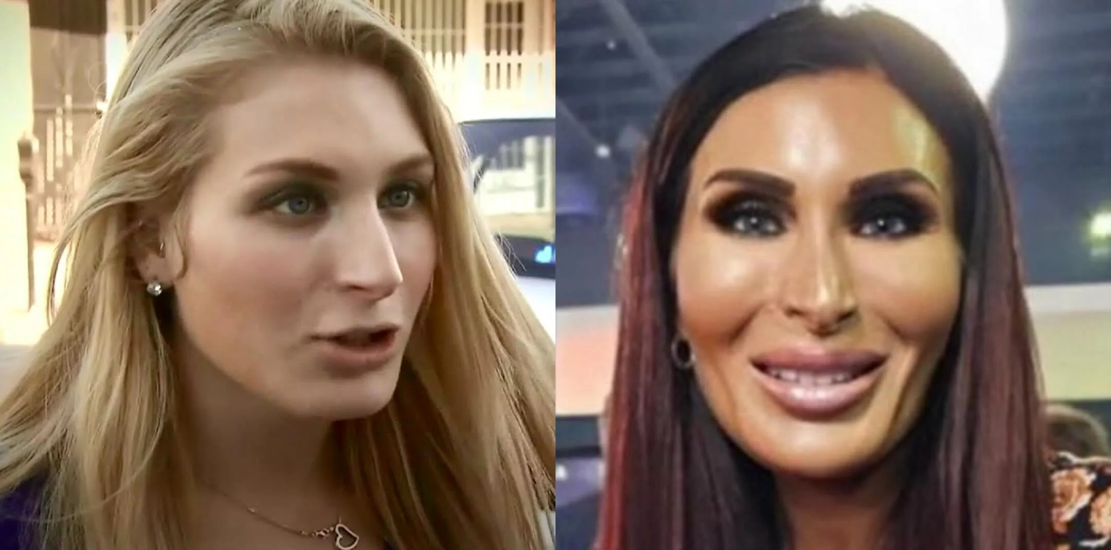 High Quality Laura Loomer Before and After plastic surgery Blank Meme Template