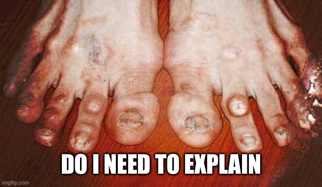 Ugly Feet | DO I NEED TO EXPLAIN | image tagged in ugly feet | made w/ Imgflip meme maker