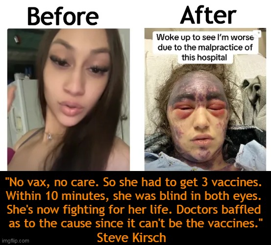 Alexis w/ a history of PNH, was given Tetanus, Pneumococcal, & Meningitis vaccines together at Dr's insistence or wouldn't be tr | Before; After; "No vax, no care. So she had to get 3 vaccines. 
Within 10 minutes, she was blind in both eyes. 
She's now fighting for her life. Doctors baffled 
as to the cause since it can't be the vaccines."; Steve Kirsch | image tagged in politics,vaccines,bill gates loves vaccines,vaccine injury,medical malpractice,steve kirsch | made w/ Imgflip meme maker