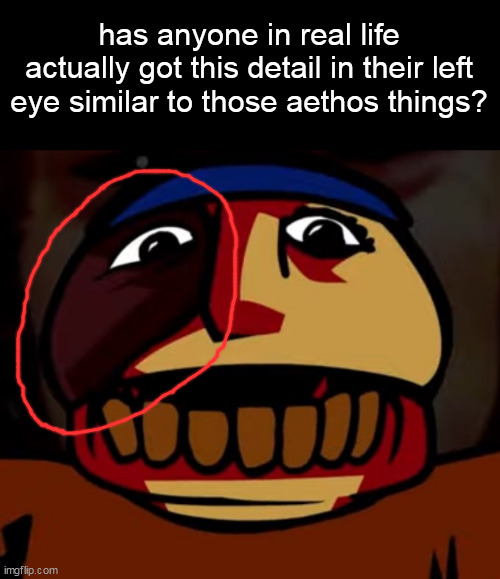 Aethos | has anyone in real life actually got this detail in their left eye similar to those aethos things? | image tagged in aethos | made w/ Imgflip meme maker