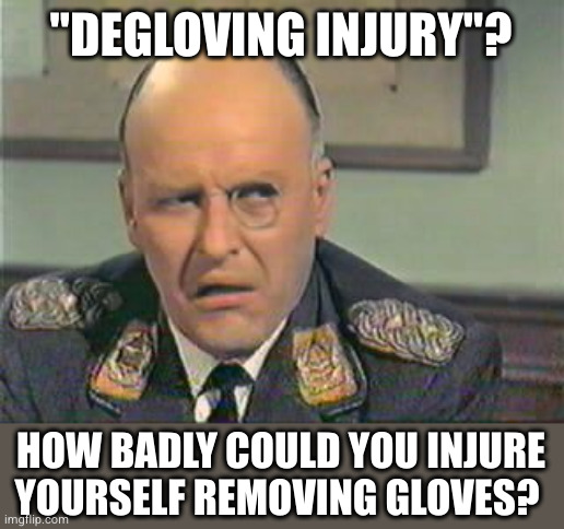 incredulous klink | "DEGLOVING INJURY"? HOW BADLY COULD YOU INJURE YOURSELF REMOVING GLOVES? | image tagged in incredulous klink | made w/ Imgflip meme maker