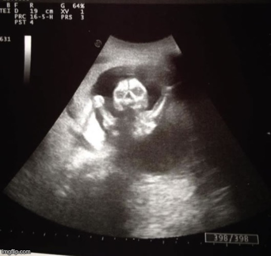 ultrasound | image tagged in ultrasound | made w/ Imgflip meme maker