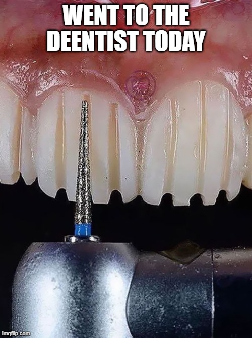 Dental Work | WENT TO THE DEENTIST TODAY | image tagged in cursed image | made w/ Imgflip meme maker