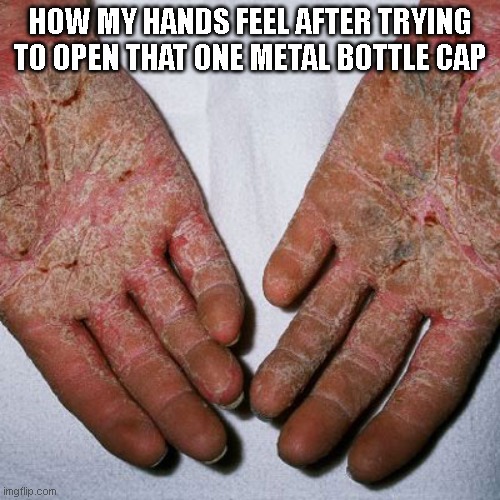 It hurts! | HOW MY HANDS FEEL AFTER TRYING TO OPEN THAT ONE METAL BOTTLE CAP | image tagged in funny,memes,meme,funny memes,fun,funny meme | made w/ Imgflip meme maker