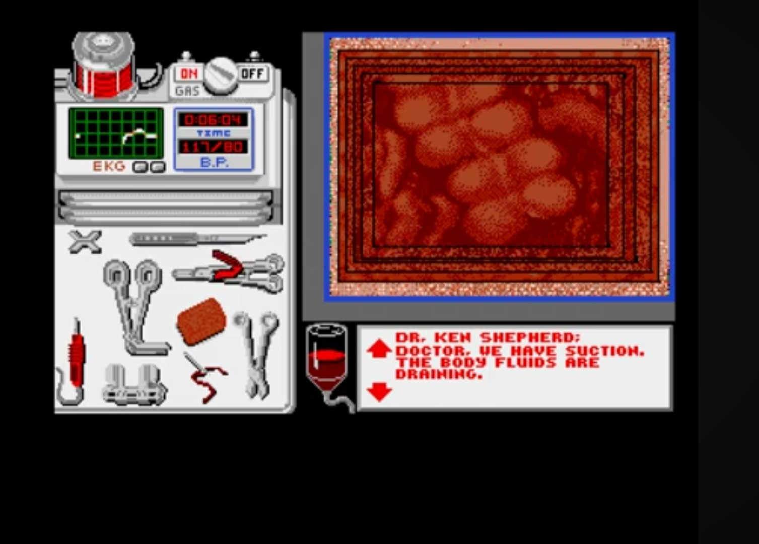 Life and Death Amiga surgery Blank Meme Template